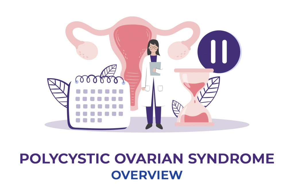 Polycystic Ovarian Syndrome - Overview